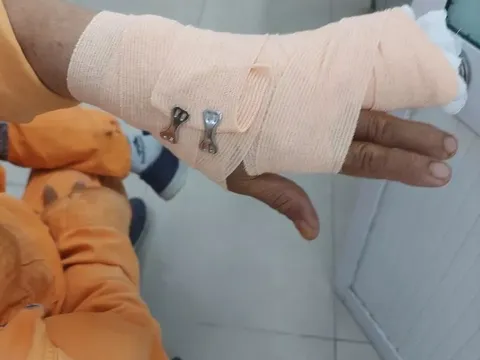 Nhắc đóng tiền điện, nhân viên điện lực ở TP.HCM bị khách tấn công