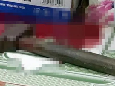 Nam nhân viên dùng búa tấn công con gái chủ quán vì bị từ chối tình cảm