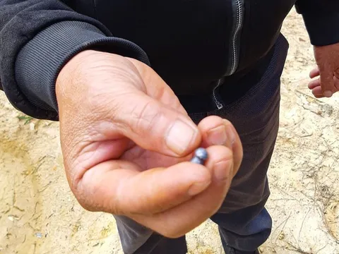 Lâm Đồng: Điều tra vụ cán bộ bảo vệ rừng bị đạn chì bắn vào lưng