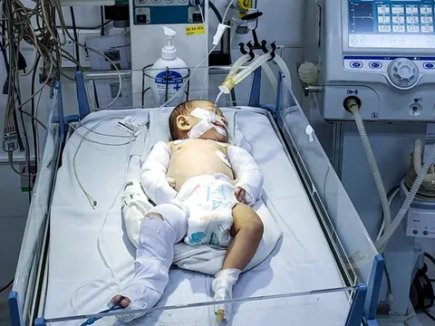 Lâm Đồng: Bắt nghi phạm bạo hành con gái 2 tháng tuổi của người tình