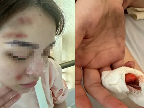 Xác minh thông tin cảnh sát hình sự ở Hải Phòng bị tố hành hung bạn gái