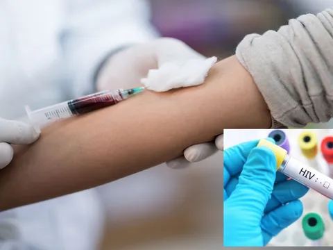 Quy định mới nhất về điều kiện xác định người nhiễm HIV do tai nạn rủi ro nghề nghiệp