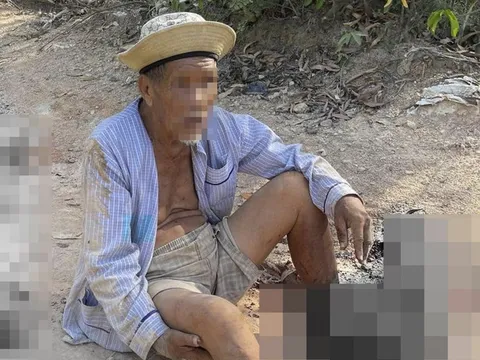 Truy tìm xe ben tông nát hai bàn chân cụ ông 85 tuổi rồi bỏ trốn