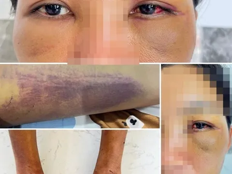 Điều tra vụ người phụ nữ tố bị gia đình chồng cũ đánh đập