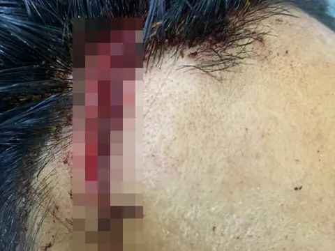 Đắk Nông: Điều tra nhóm đối tượng xông vào chốt đánh úp lực lượng bảo vệ rừng