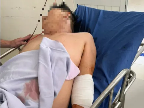 Điều tra vụ tài xế xe tải bị chém nhập viện ở Đà Nẵng