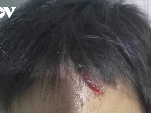 Điều tra vụ bé trai 10 tuổi nghi bị mẹ kế tiếp tục bạo hành ở Cà Mau