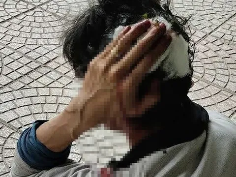 Điều tra vụ nam shipper bị chém gục khi giao hàng ở Bình Dương