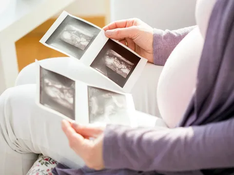 Bộ Y tế đề xuất phạt đến 100 triệu đồng nếu lựa chọn giới tính thai nhi